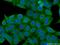 Protein Phosphatase 1 Regulatory Subunit 12A antibody, 22117-1-AP, Proteintech Group, Immunofluorescence image 