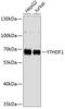 YTH N6-Methyladenosine RNA Binding Protein 1 antibody, 14-875, ProSci, Western Blot image 