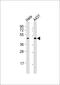 Left-Right Determination Factor 2 antibody, M06558-1, Boster Biological Technology, Western Blot image 