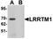 Leucine Rich Repeat Transmembrane Neuronal 1 antibody, A08006, Boster Biological Technology, Western Blot image 