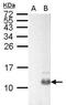 PPY antibody, PA5-78121, Invitrogen Antibodies, Western Blot image 