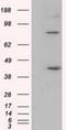 DExD-Box Helicase 39B antibody, NBP2-02553, Novus Biologicals, Western Blot image 