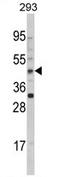 Arylacetamide Deacetylase antibody, AP17069PU-N, Origene, Western Blot image 