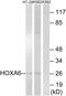 Homeobox A6 antibody, A30124, Boster Biological Technology, Western Blot image 