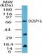 Dual Specificity Phosphatase 16 antibody, NBP2-24501, Novus Biologicals, Western Blot image 