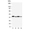 Hydroxysteroid 11-Beta Dehydrogenase 1 antibody, R30440, NSJ Bioreagents, Western Blot image 