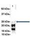 Chromatin Target Of PRMT1 antibody, GTX45303, GeneTex, Immunoprecipitation image 