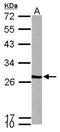 VHL Binding Protein 1 antibody, TA307944, Origene, Western Blot image 