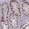 Zinc Finger Protein 813 antibody, NBP2-31638, Novus Biologicals, Immunohistochemistry paraffin image 