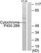 Cytochrome P450 Family 2 Subfamily B Member 6 antibody, TA311800, Origene, Western Blot image 
