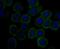 Carbonic anhydrase 2 antibody, NBP2-76824, Novus Biologicals, Immunocytochemistry image 