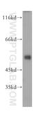 Lactamase Beta antibody, 18195-1-AP, Proteintech Group, Western Blot image 