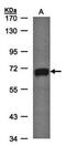 Polypeptide N-Acetylgalactosaminyltransferase 2 antibody, orb74120, Biorbyt, Western Blot image 