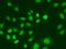 Ubiquitin Conjugating Enzyme E2 V1 antibody, orb247364, Biorbyt, Immunofluorescence image 
