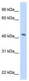 MAGE Family Member A1 antibody, TA339276, Origene, Western Blot image 