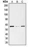 Solute Carrier Family 29 Member 1 (Augustine Blood Group) antibody, LS-C352167, Lifespan Biosciences, Western Blot image 