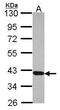 11-cis retinol dehydrogenase antibody, PA5-30150, Invitrogen Antibodies, Western Blot image 
