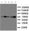 Heat Shock Transcription Factor 1 antibody, LS-C312765, Lifespan Biosciences, Western Blot image 
