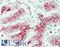 PTTG1 Interacting Protein antibody, LS-B14567, Lifespan Biosciences, Immunohistochemistry paraffin image 