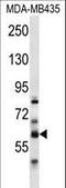 Phosphatidylserine Synthase 2 antibody, LS-C162268, Lifespan Biosciences, Western Blot image 