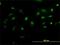NIMA Related Kinase 2 antibody, H00004751-M02, Novus Biologicals, Immunocytochemistry image 