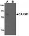 Histone-arginine methyltransferase CARM1 antibody, TA319822, Origene, Western Blot image 
