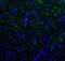 Hepatitis A Virus Cellular Receptor 2 antibody, RF16105, ProSci Inc, Immunofluorescence image 