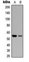 Myocyte Enhancer Factor 2C antibody, orb256682, Biorbyt, Western Blot image 