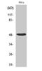 Heterogeneous nuclear ribonucleoprotein H antibody, A07691-1, Boster Biological Technology, Western Blot image 