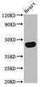 TRNA Aspartic Acid Methyltransferase 1 antibody, CSB-PA675694LA01HU, Cusabio, Western Blot image 