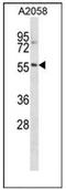 NACC Family Member 2 antibody, AP52805PU-N, Origene, Western Blot image 