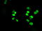 SATB Homeobox 1 antibody, M01312-1, Boster Biological Technology, Immunofluorescence image 