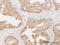 L-xylulose reductase antibody, LS-C133753, Lifespan Biosciences, Immunohistochemistry paraffin image 