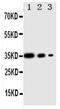 Eukaryotic Translation Initiation Factor 2 Alpha Kinase 3 antibody, PA2026, Boster Biological Technology, Western Blot image 