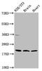 NADH:Ubiquinone Oxidoreductase Subunit B8 antibody, LS-C672880, Lifespan Biosciences, Western Blot image 