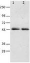 Matrix metalloproteinase-17 antibody, orb107551, Biorbyt, Western Blot image 