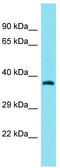 Centrosomal Protein 89 antibody, TA333603, Origene, Western Blot image 