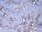 Galectin 1 antibody, A00470, Boster Biological Technology, Immunohistochemistry paraffin image 