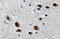 Sodium Voltage-Gated Channel Alpha Subunit 2 antibody, AP20673PU-N, Origene, Immunohistochemistry paraffin image 