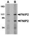 Folliculin-interacting protein 2 antibody, orb75149, Biorbyt, Western Blot image 
