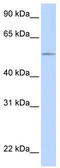 UDP Glucuronosyltransferase Family 1 Member A1 antibody, TA335239, Origene, Western Blot image 