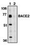 Beta-secretase 2 antibody, AP05098PU-N, Origene, Western Blot image 