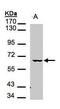 Serine/threonine-protein kinase MAK antibody, PA5-28593, Invitrogen Antibodies, Western Blot image 