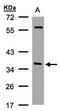 NSF Attachment Protein Alpha antibody, orb73916, Biorbyt, Western Blot image 