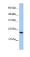 ADP Ribosylation Factor Like GTPase 5A antibody, orb326032, Biorbyt, Western Blot image 