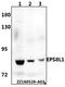 EPS8 Like 1 antibody, A12387, Boster Biological Technology, Western Blot image 