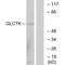 Glycerate Kinase antibody, A12308, Boster Biological Technology, Western Blot image 