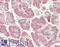 Collagen Type X Alpha 1 Chain antibody, LS-B14811, Lifespan Biosciences, Immunohistochemistry paraffin image 