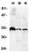 TNF Receptor Superfamily Member 6b antibody, AHP1603, Bio-Rad (formerly AbD Serotec) , Western Blot image 
