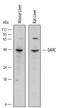 Atypical Chemokine Receptor 1 (Duffy Blood Group) antibody, PA5-47861, Invitrogen Antibodies, Western Blot image 